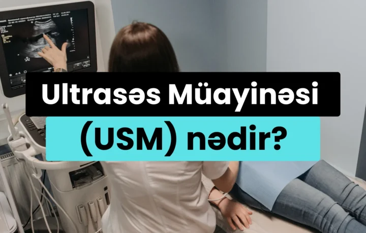 USM